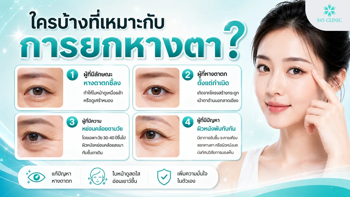 ใครบ้างที่เหมาะกับการยกหางตา