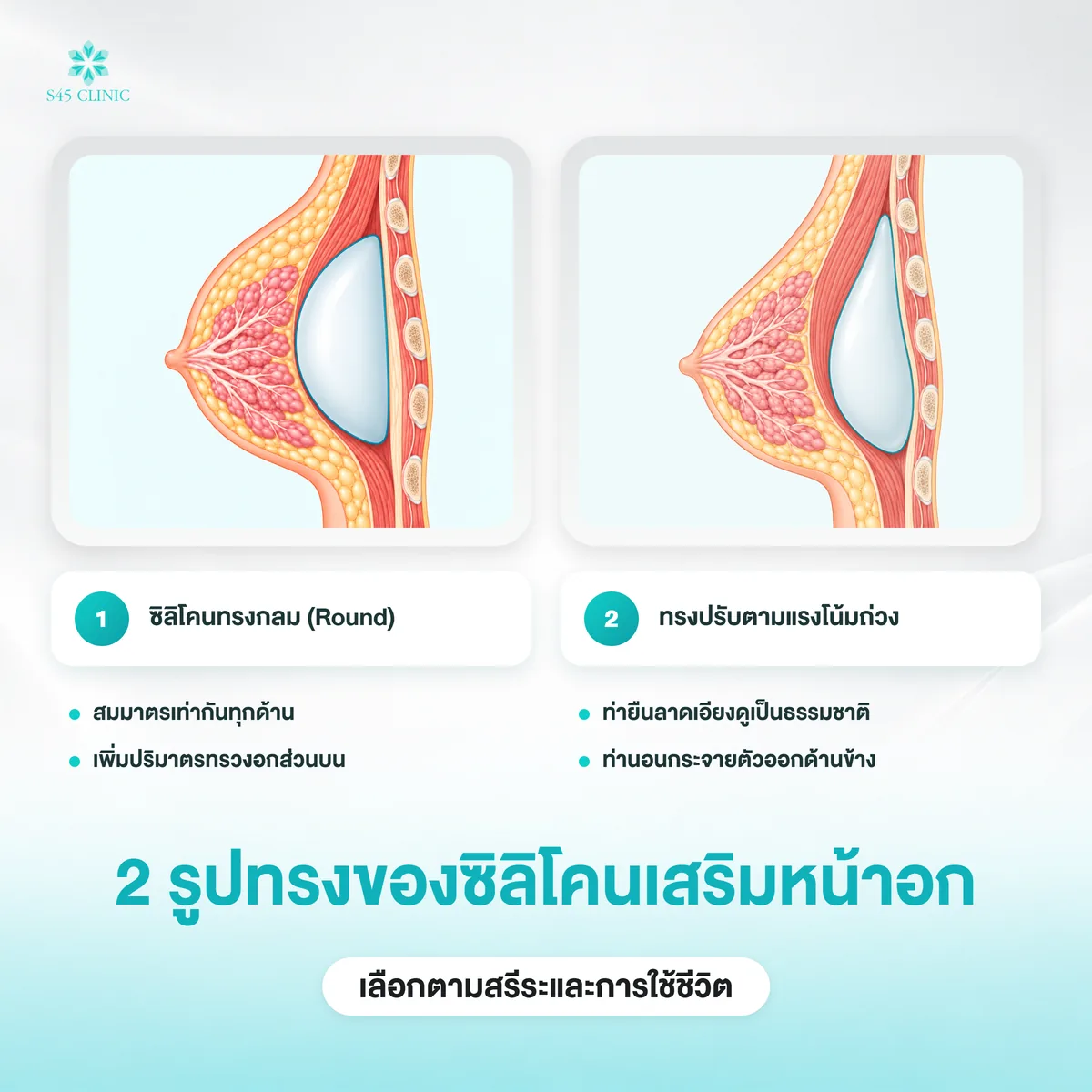 ซิลิโคนเสริมหน้าอก 2 รูปทรง ทรงกลมกับทรงที่ปรับตามแรงโน้มถ่วง