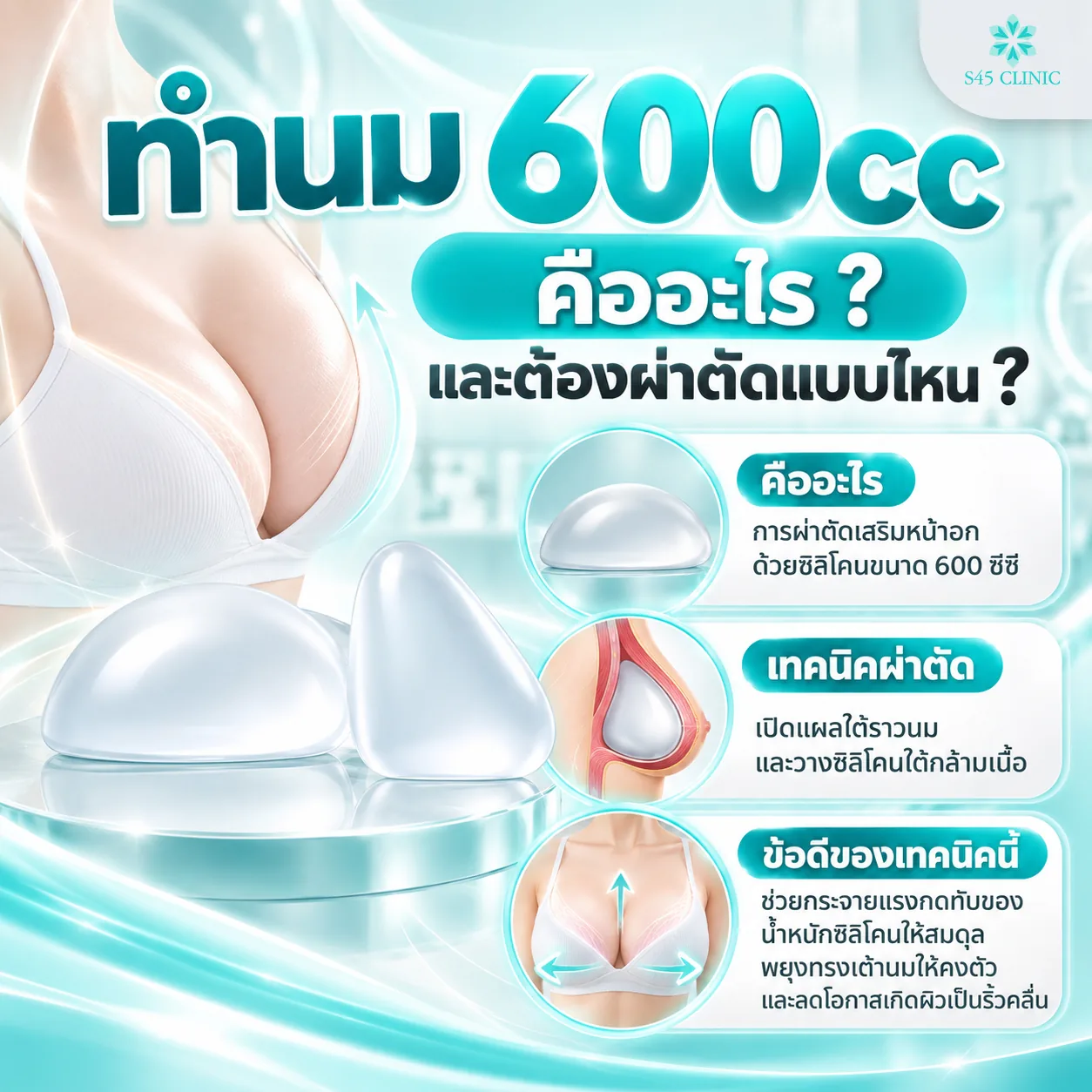 Infographic in Thai on what 600cc breast augmentation is and what surgery it involves: breast augmentation with 600cc silicone implants, an incision under the breast with the implant placed under the muscle, and how this technique helps spread the weight of the implant, support the breast shape and lower the chance of rippling