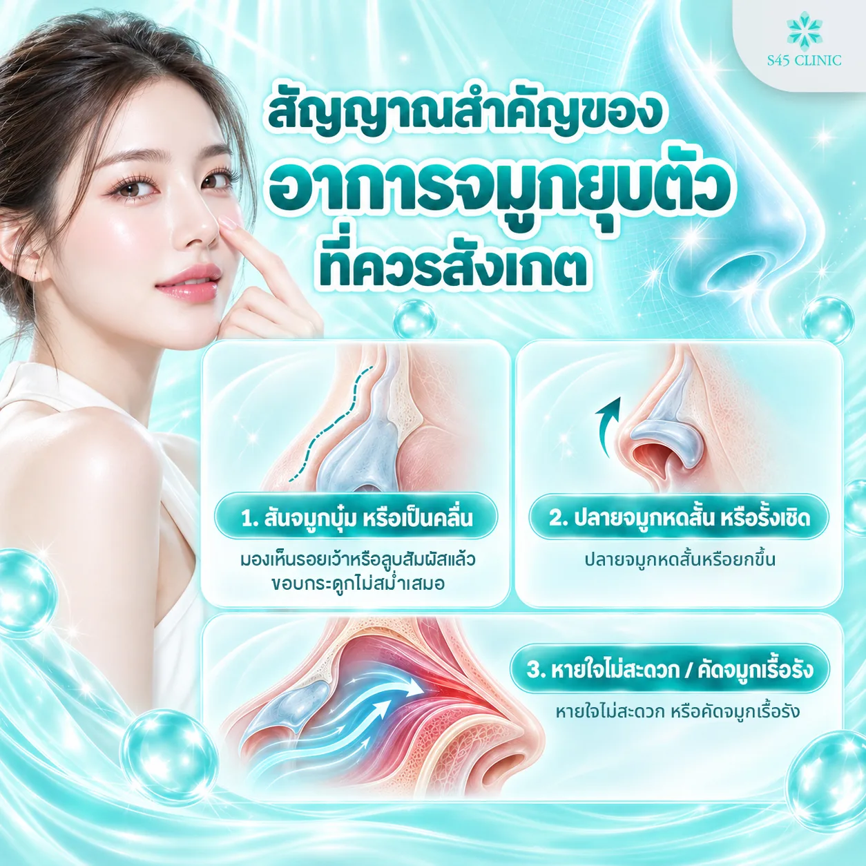 Infographic in Thai titled 'Key signs of a collapsing nose to look out for', with illustrations of the nose and 3 signs: a dented or wavy bridge, where you can see a hollow or feel an uneven bony edge, a nose tip that is shorter or pulled up, and difficulty breathing or a long-term blocked nose