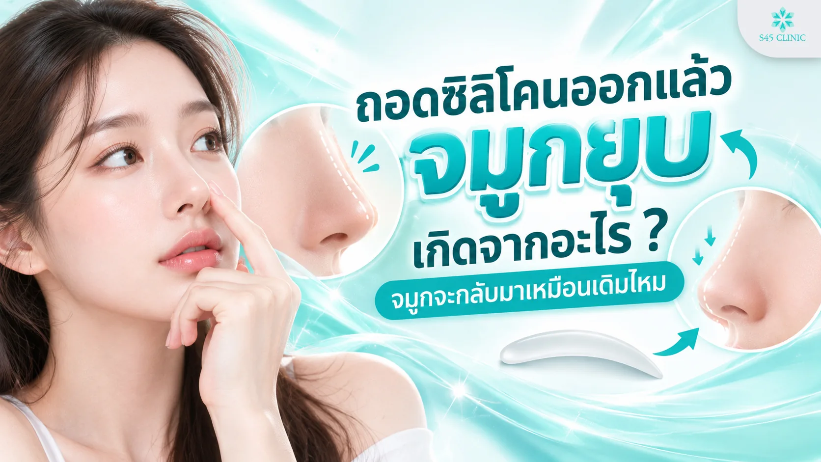 ภาพประกอบบทความถอดซิลิโคนออกแล้วจมูกยุบ หญิงแตะสันจมูก พร้อมภาพจมูกก่อนและหลังถอดซิลิโคน