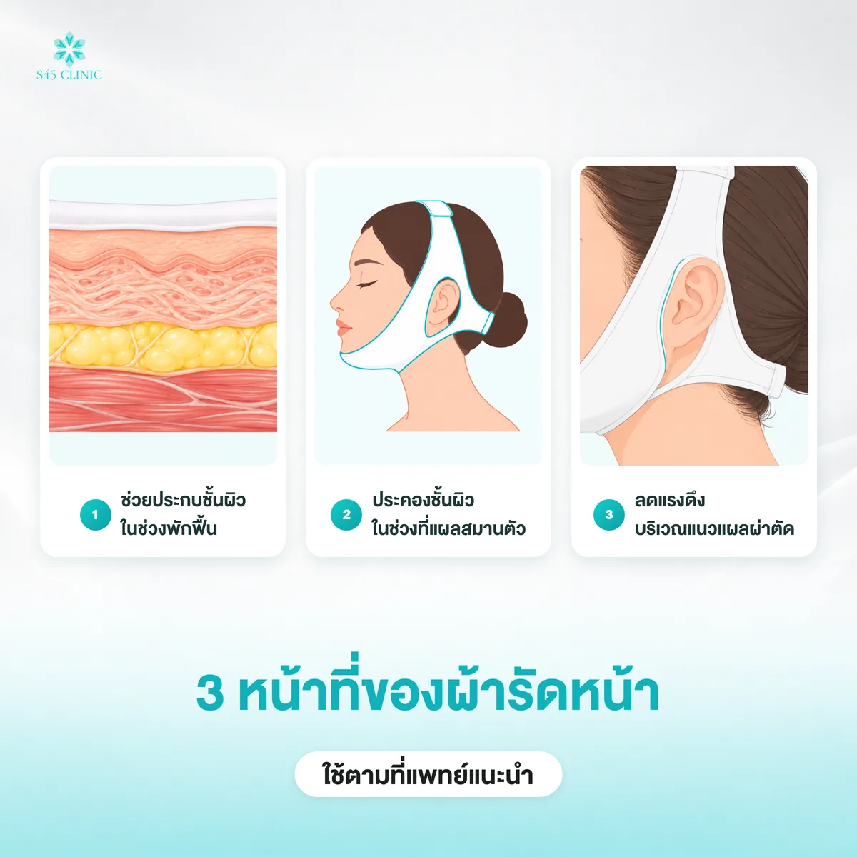 3 หน้าที่ของผ้ารัดหน้า ประคองชั้นผิวช่วงพักฟื้นและลดแรงดึงบริเวณแนวแผลผ่าตัด