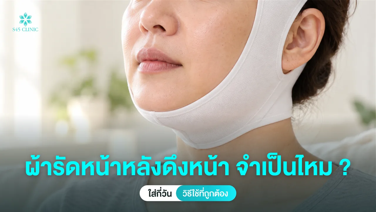 หญิงวัยกลางคนสวมผ้ารัดหน้าคลุมคางถึงหลังใบหูในช่วงพักฟื้นหลังดึงหน้า