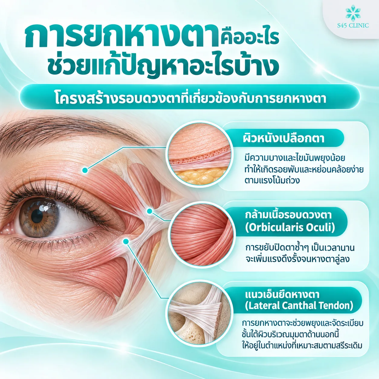 โครงสร้างรอบดวงตาที่เกี่ยวข้องกับการยกหางตา ผิวหนังเปลือกตา กล้ามเนื้อรอบดวงตา และเอ็นยึดหางตา