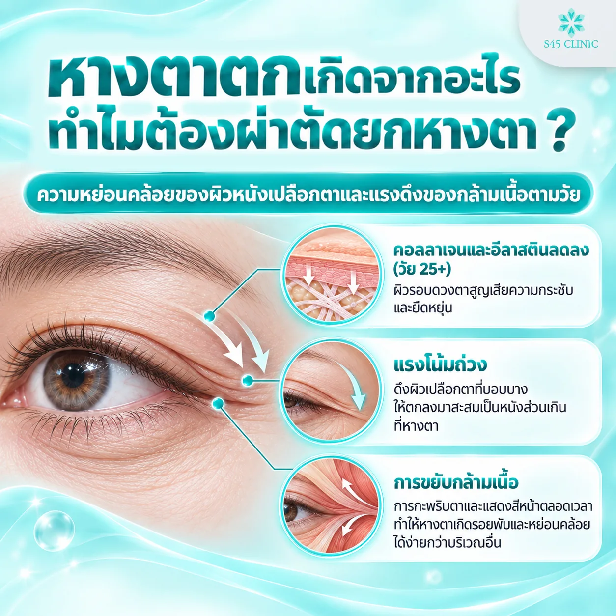 สาเหตุหางตาตก คอลลาเจนลดลง แรงโน้มถ่วง และการขยับกล้ามเนื้อรอบดวงตา