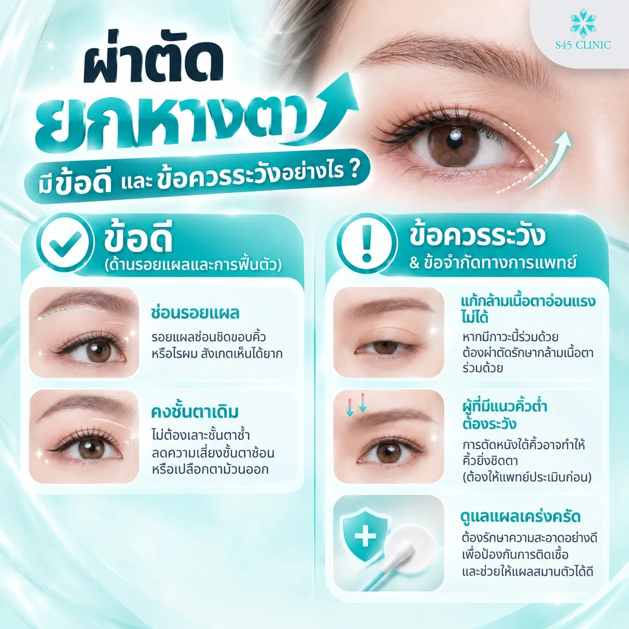 ข้อดีและข้อควรระวังของการผ่าตัดยกหางตา ซ่อนรอยแผล คงชั้นตาเดิม และข้อจำกัดทางการแพทย์
