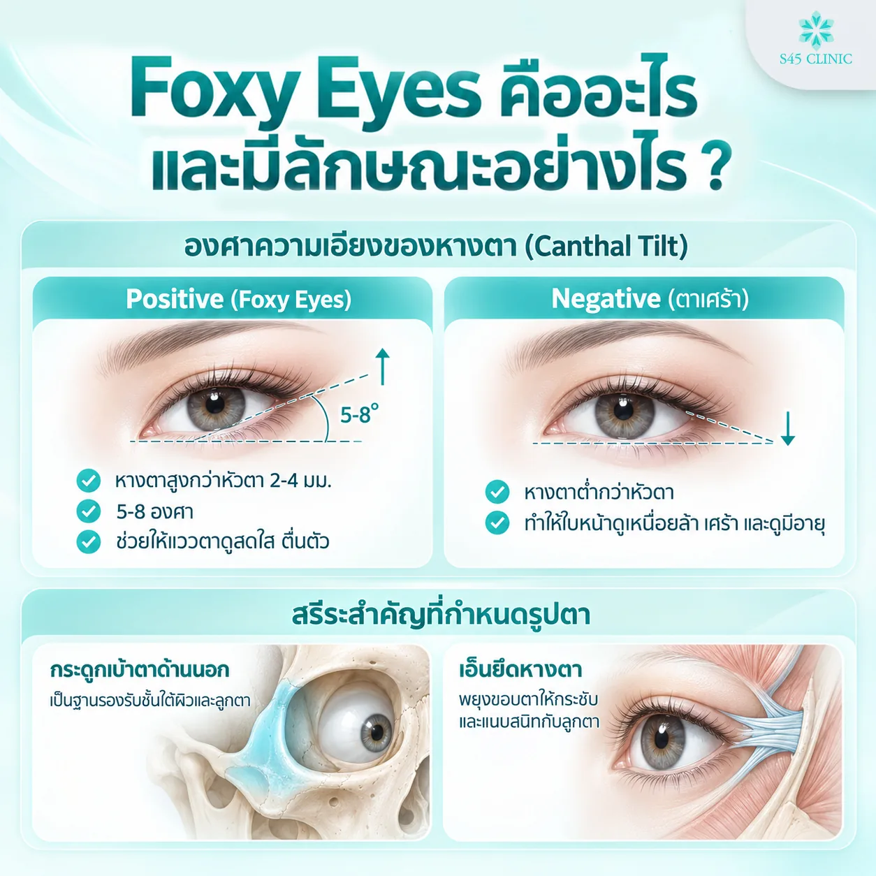 What fox eyes are, shown by canthal tilt, the angle of the outer eye corner. A positive tilt (fox eyes) has the outer corner 2mm to 4mm higher than the inner corner, at 5 to 8 degrees, which helps the eyes look bright and alert. A negative tilt (sometimes called sad eyes) has the outer corner lower than the inner corner, which makes the face look tired, sad and older. The key anatomy that shapes the eyes is the outer eye socket bone, which supports the tissue beneath the skin and the eyeball, and the tendon at the outer eye corner, which keeps the edge of the eyelid firm and close to the eyeball