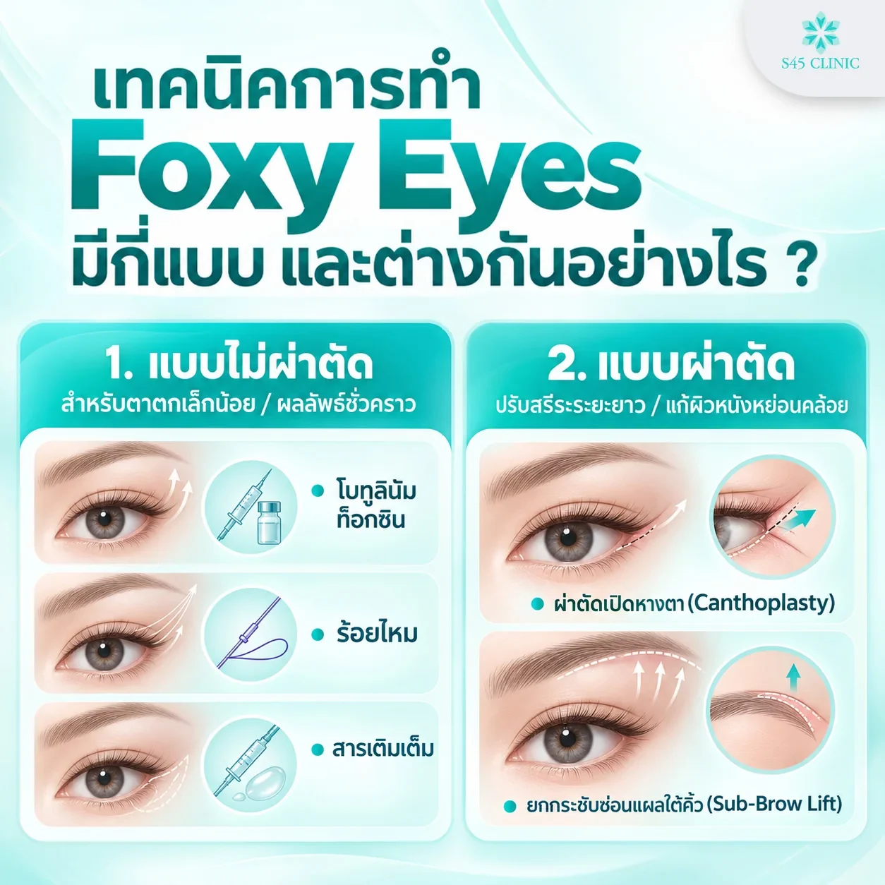 Fox eye techniques. 1. Non-surgical, for mildly droopy eye corners, with temporary results: botulinum toxin injections, a thread lift and filler injections. 2. Surgical, to change the anatomy over the long term and correct sagging skin: canthoplasty, which opens and reshapes the outer eye corner, and a sub-brow lift with a hidden scar beneath the eyebrow