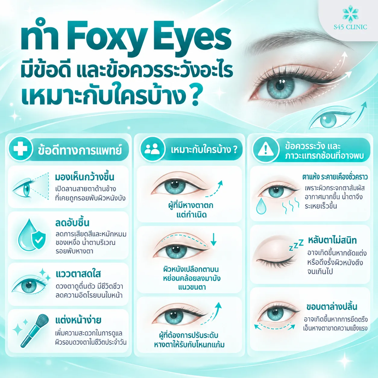Benefits, suitable candidates and precautions of fox eye treatment. Medical benefits: wider side vision, less trapped moisture, brighter-looking eyes and easier makeup. Suitable for people whose outer eye corners have drooped since birth, people whose upper eyelid skin sags over the lashes, and people who want their outer eye corners to suit their cheekbones. Precautions and possible complications: temporary dry, irritated eyes, eyelids not closing fully, and the lower eyelid turning outwards