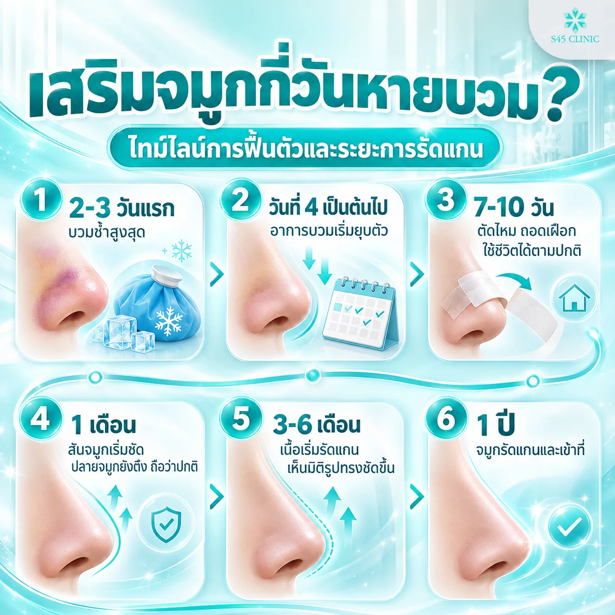 ไทม์ไลน์การฟื้นตัวหลังเสริมจมูก ตั้งแต่ 2-3 วันแรกที่บวมสูงสุด จนถึง 1 ปีที่จมูกรัดแกนและเข้าที่