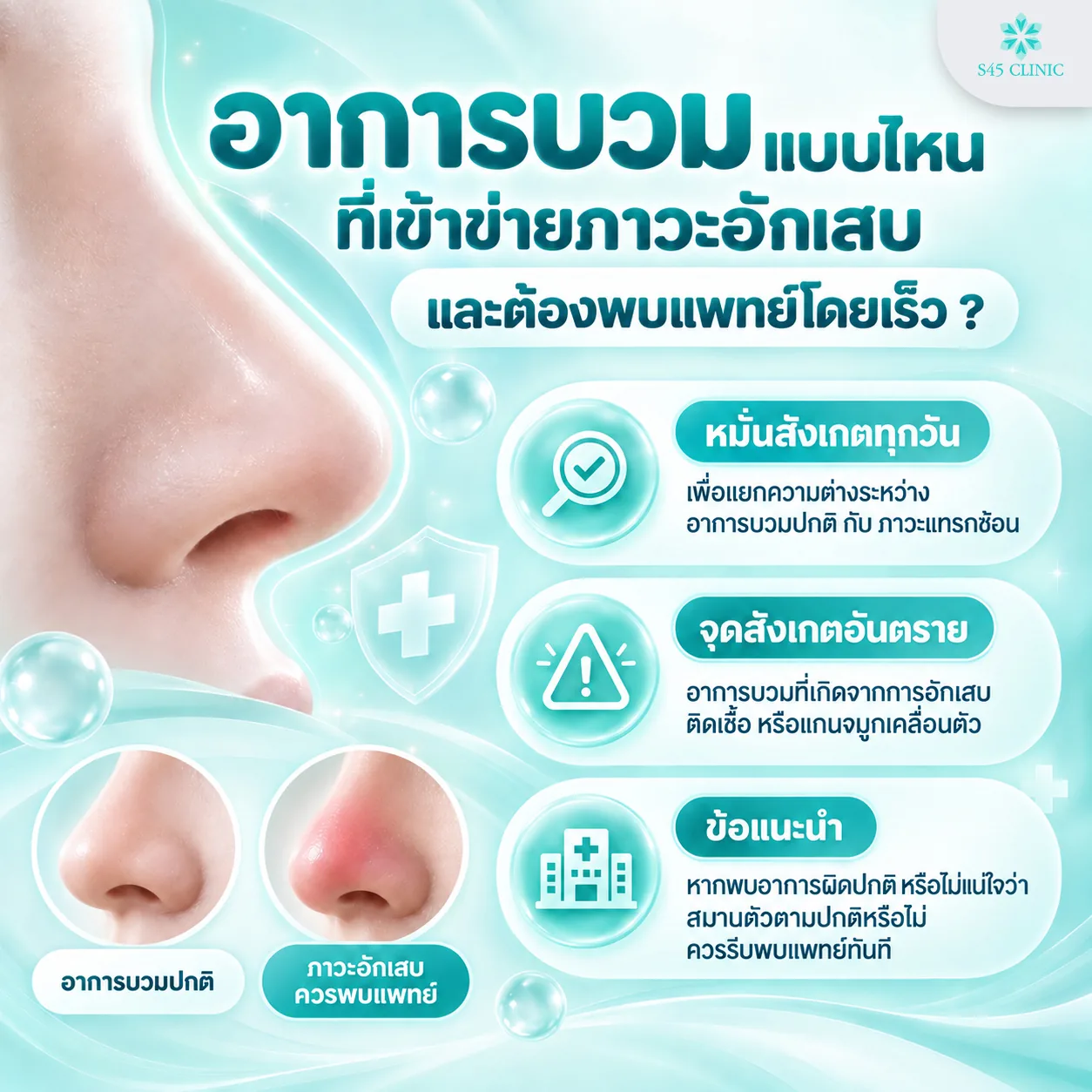 อาการบวมแบบไหนเข้าข่ายภาวะอักเสบ เปรียบเทียบอาการบวมปกติกับภาวะอักเสบที่ควรพบแพทย์