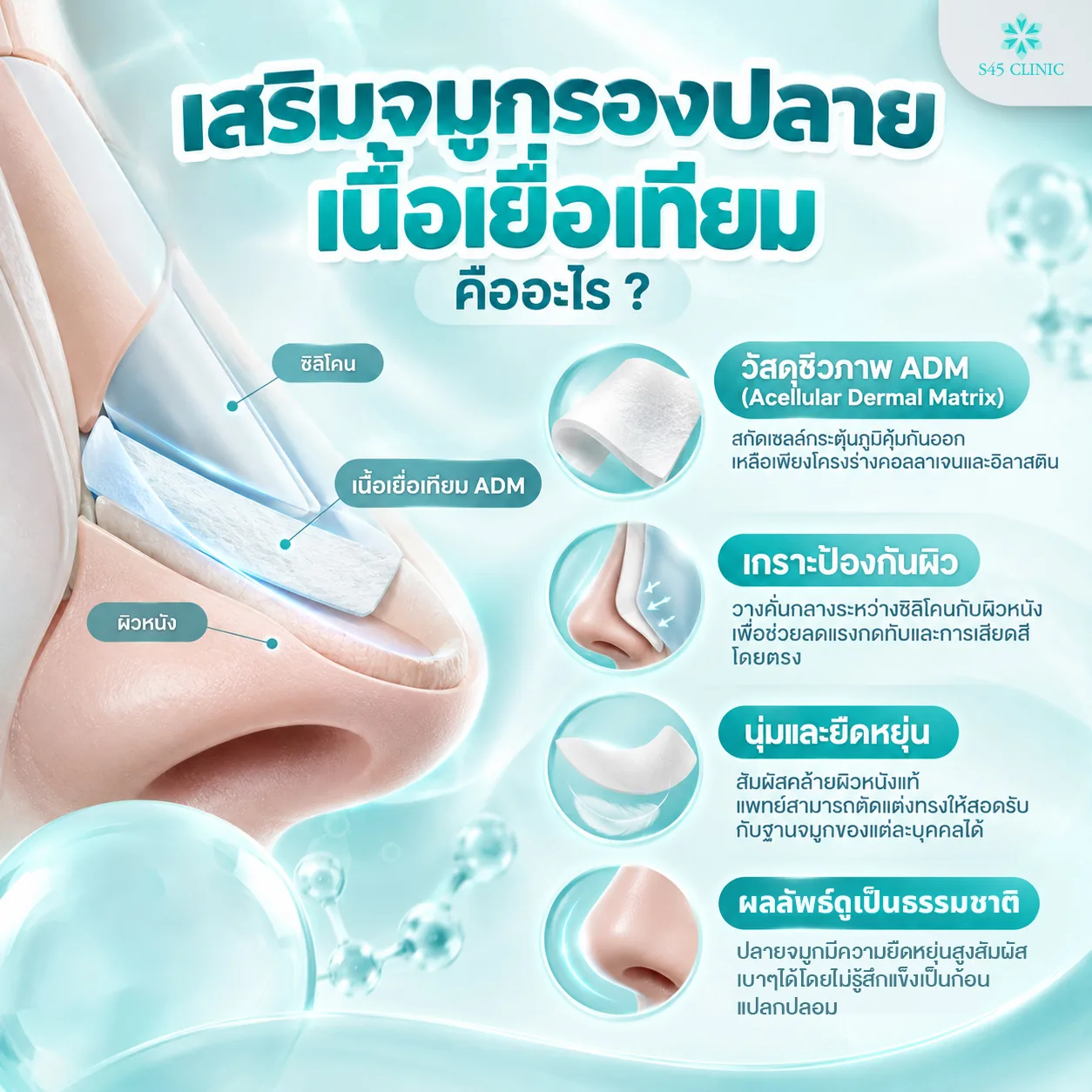 เสริมจมูกรองปลายเนื้อเยื่อเทียมคืออะไร วัสดุชีวภาพ ADM วางคั่นระหว่างซิลิโคนกับผิวหนังปลายจมูก