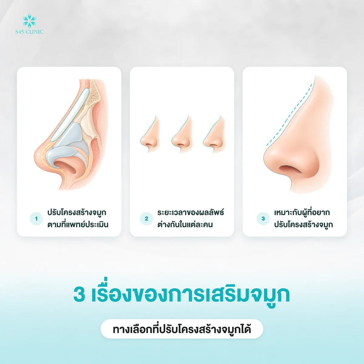 เสริมจมูกปรับโครงสร้างให้ดูโด่งเป็นธรรมชาติด้วยทรงสโลปปลายพุ่ง