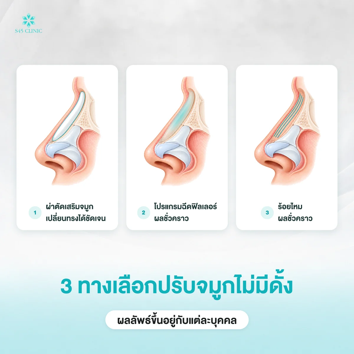 ไม่มีดั้ง วิธีแก้