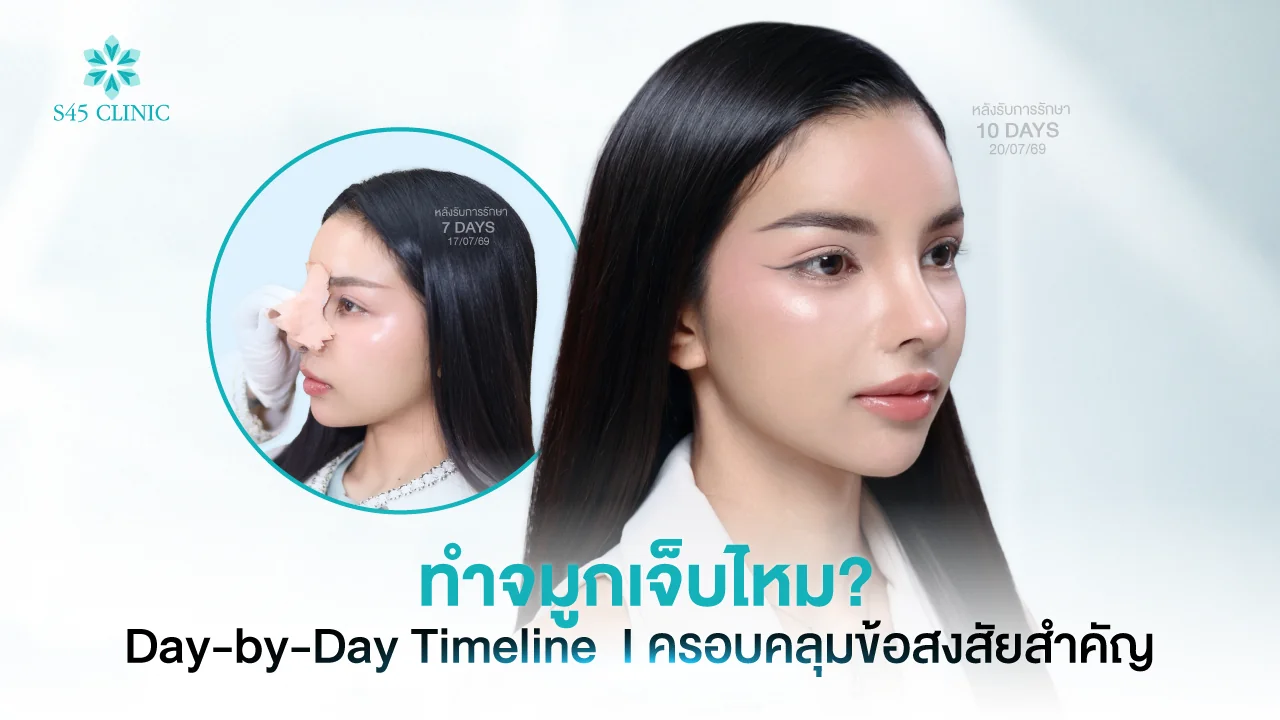ผู้รับบริการหลังทำจมูก 7 วันขณะเปลี่ยนเทปปิดจมูก และหลังทำ 10 วัน