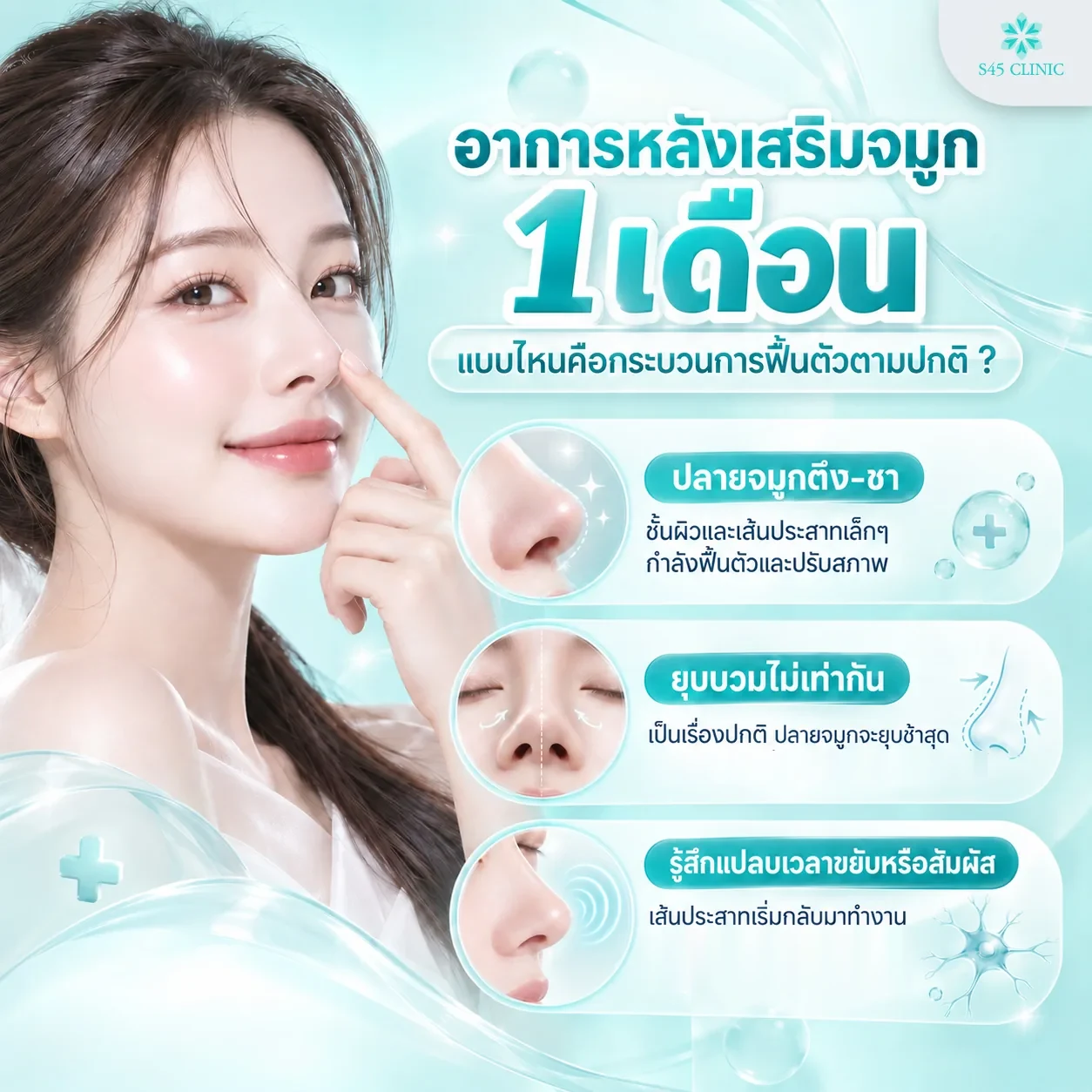 Infographic in Thai titled '1 month after rhinoplasty, which symptoms are part of normal recovery?', showing 3 common symptoms: a tight, numb nose tip, as the skin layers and small nerves recover and adjust, uneven swelling, described as normal, with the tip going down last, and a tingling feeling when moving or touching the nose, as nerves start working again