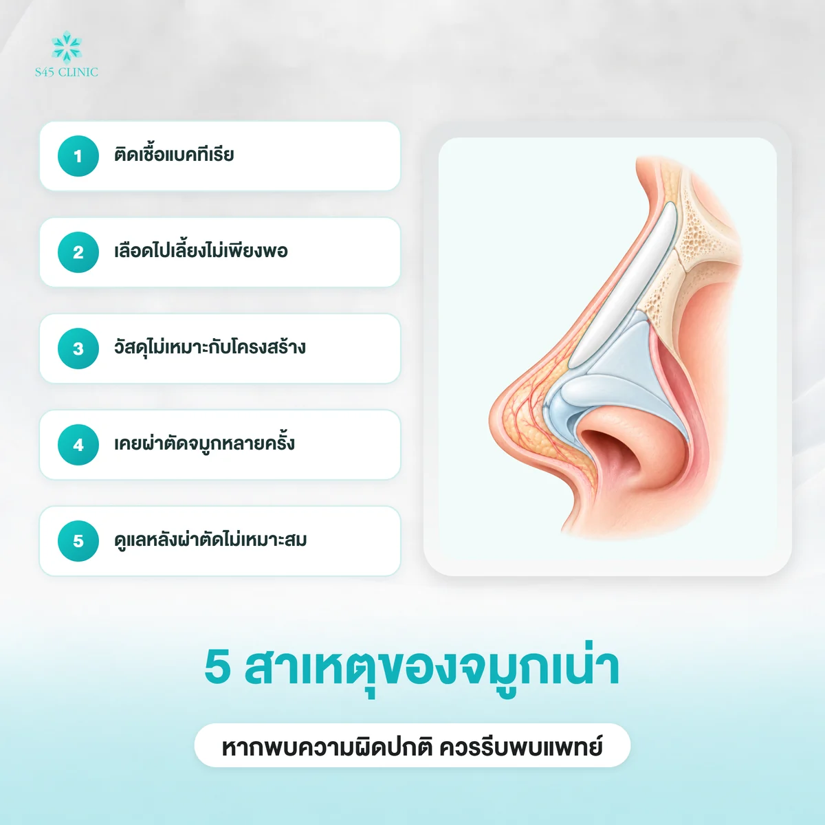 สาเหตุของจมูกเน่า ติดเชื้อ ขาดเลือดไปเลี้ยง และปัจจัยอื่น
