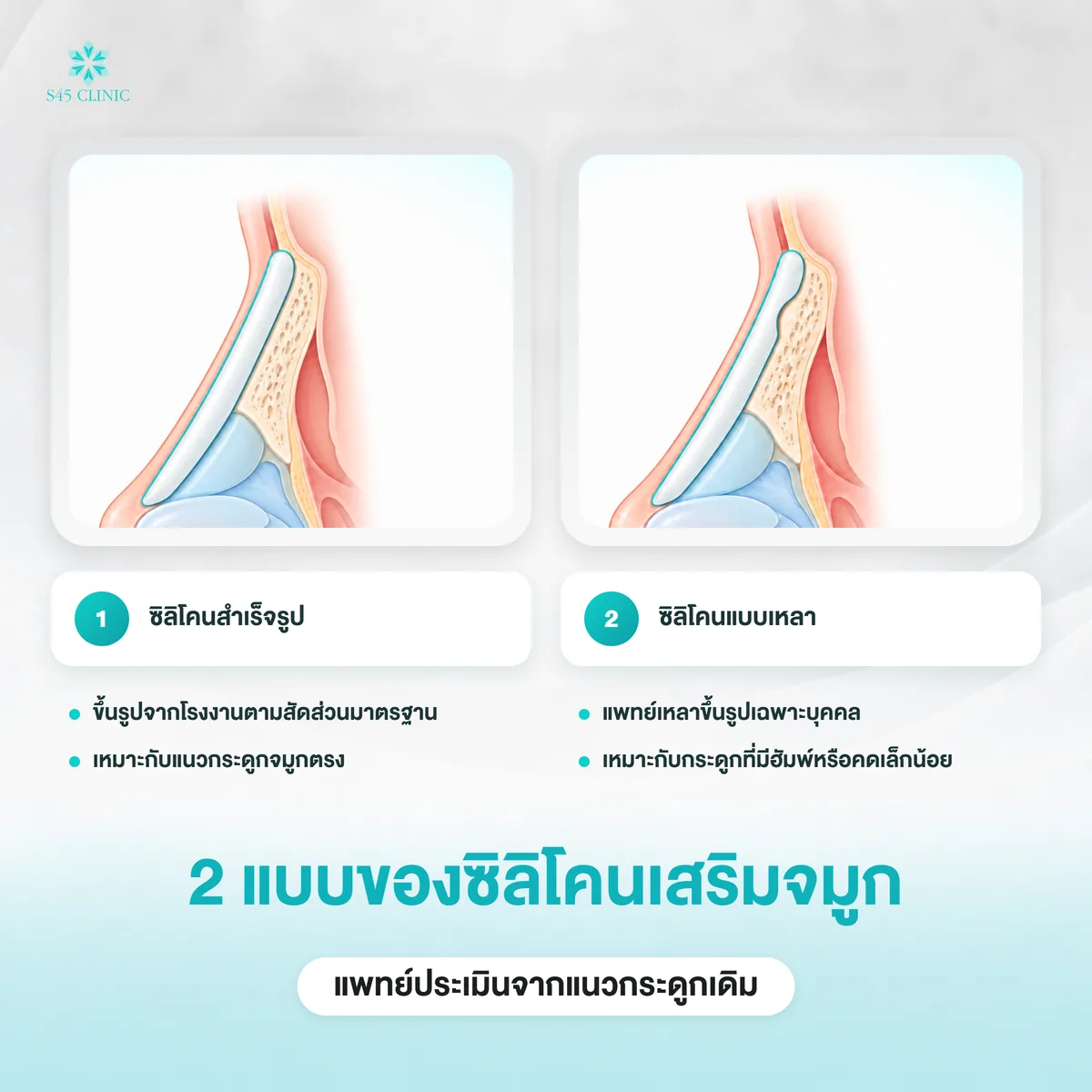 ซิลิโคนจมูก 2 แบบ ซิลิโคนสำเร็จรูปกับซิลิโคนแบบเหลาเฉพาะบุคคล