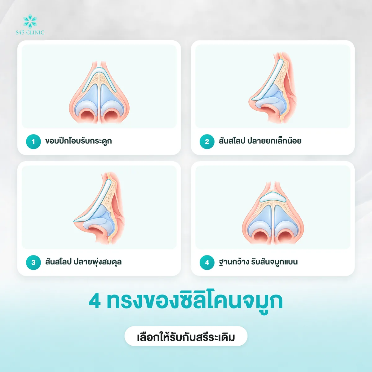 4 ทรงของซิลิโคนจมูก ขอบปีกโอบรับกระดูก สันสโลปปลายยก ปลายพุ่ง และฐานกว้าง