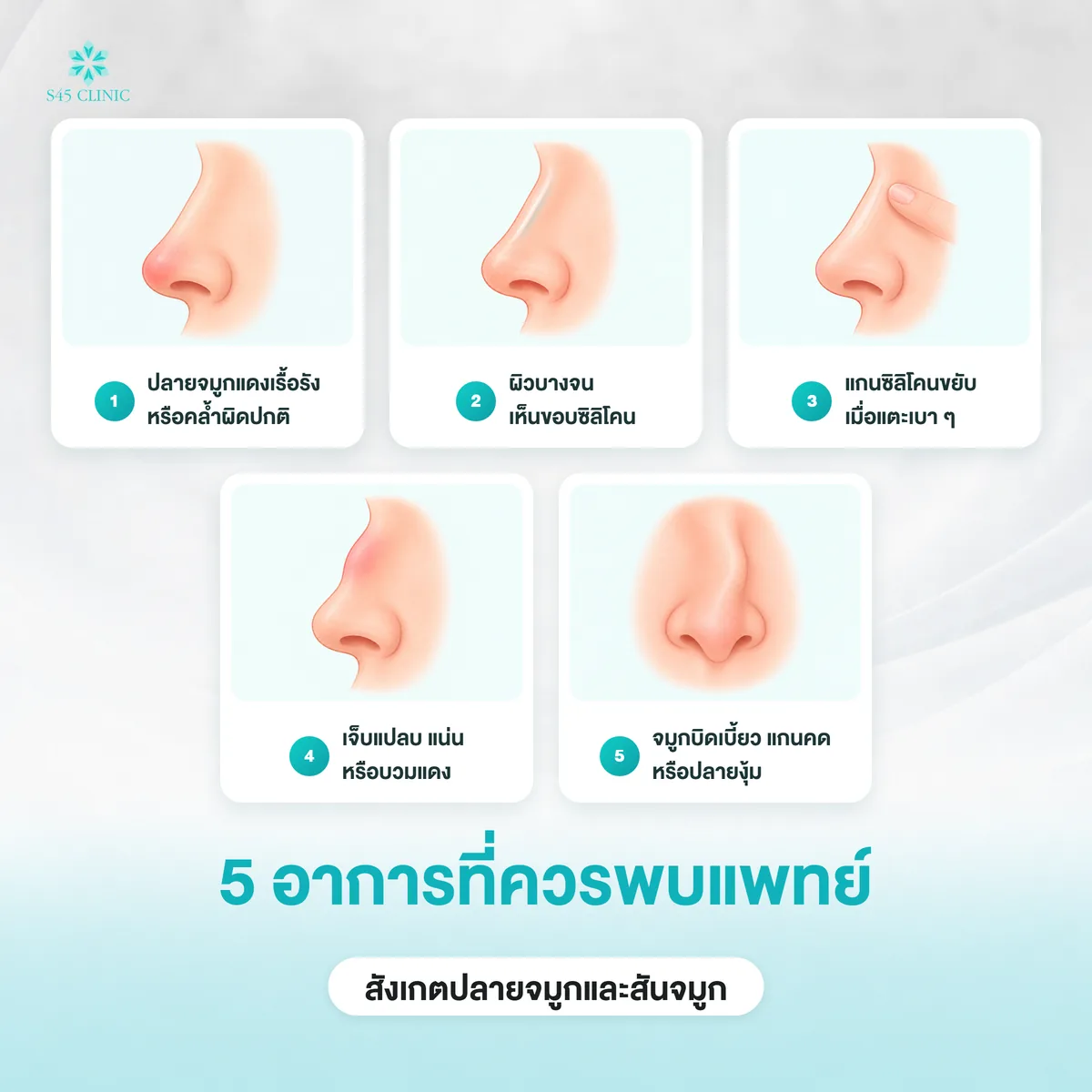 5 อาการหลังเสริมจมูกที่ควรพบแพทย์ ปลายจมูกแดง ผิวบาง แกนขยับ เจ็บบวม และจมูกบิดเบี้ยว