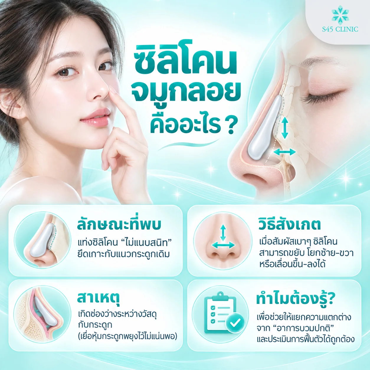 ซิลิโคนจมูกลอยคืออะไร ลักษณะที่พบ วิธีสังเกต และสาเหตุจากช่องว่างระหว่างวัสดุกับกระดูก