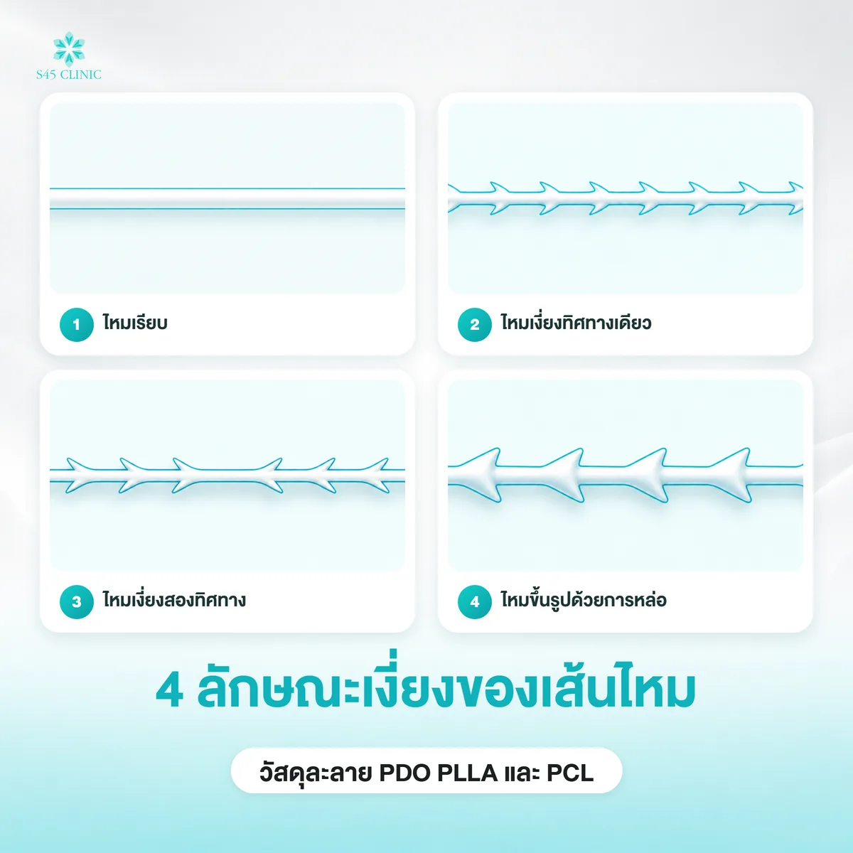 4 ลักษณะเงี่ยงของเส้นไหม ไหมเรียบ เงี่ยงทิศทางเดียว เงี่ยงสองทิศทาง และไหมขึ้นรูป