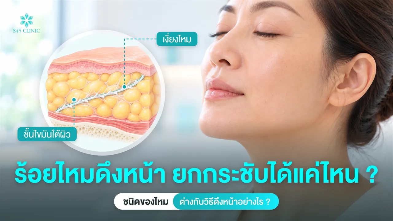 หญิงวัยกลางคนหลับตา คู่ภาพตัดขวางเงี่ยงไหมในชั้นไขมันใต้ผิว