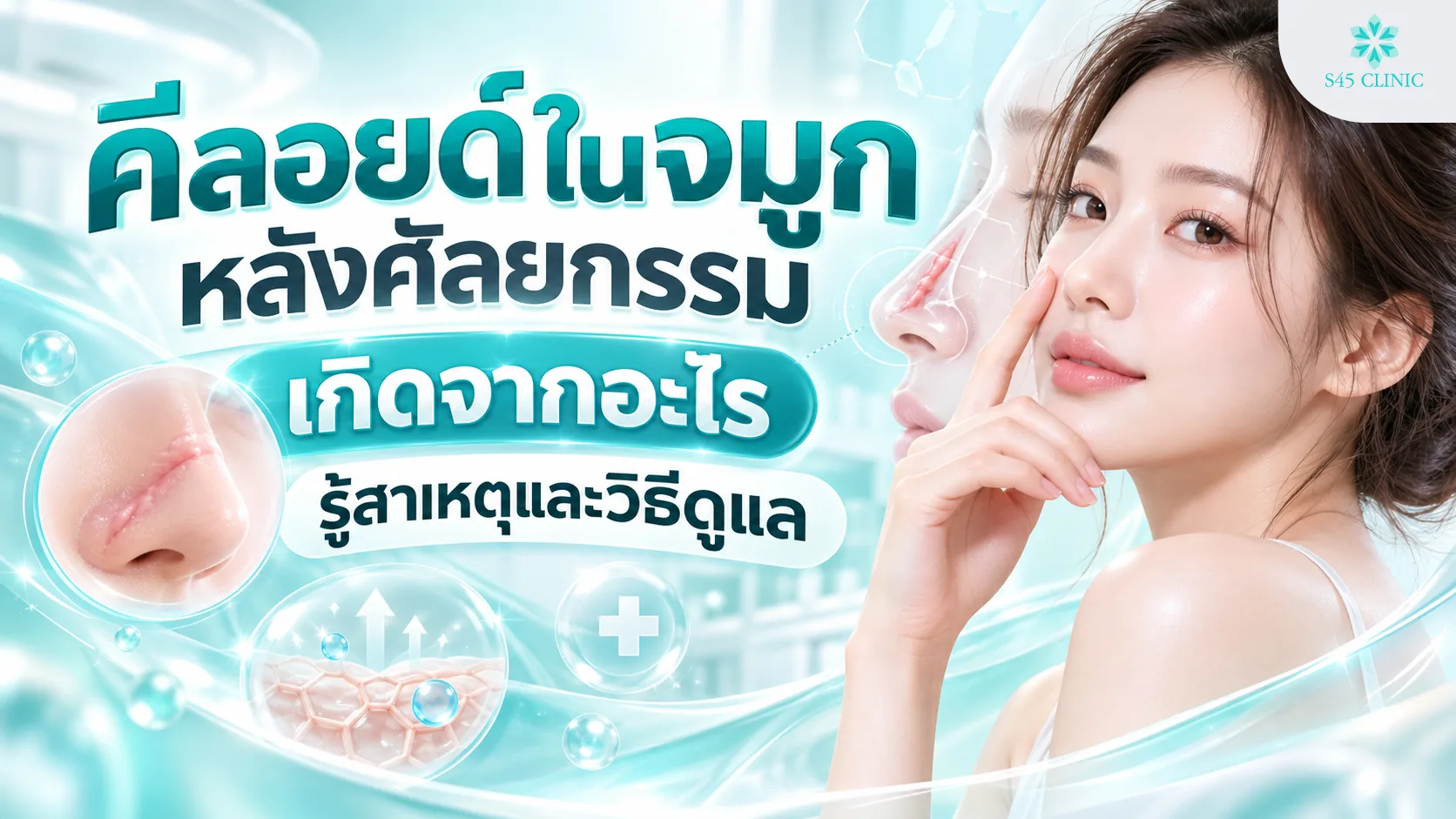 ภาพประกอบบทความคีลอยด์ในจมูกหลังศัลยกรรม หญิงแตะปลายจมูก พร้อมภาพรอยแผลนูนที่จมูก