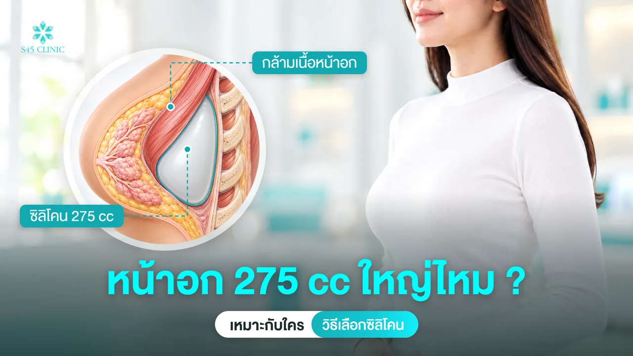 ภาพประกอบซิลิโคน 275 cc ใต้กล้ามเนื้อหน้าอก ปกบทความหน้าอก 275 cc ใหญ่ไหม